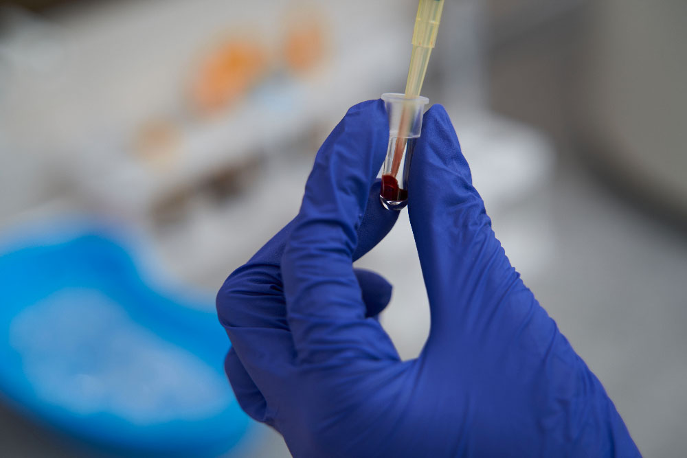 Echantillon de sang pour une analyse de THC.